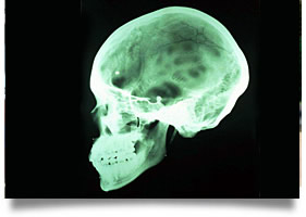 Head Injury Lawyers Oklahoma City